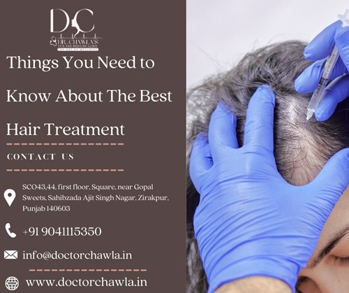 Hair Transplant in Zirakpur