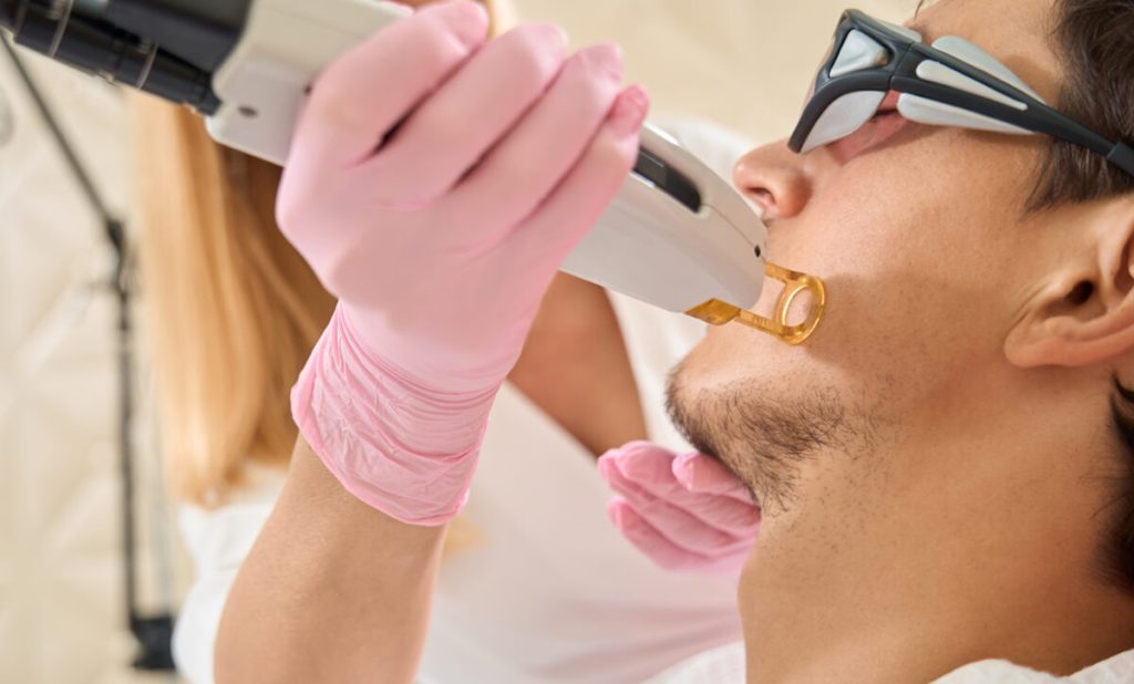Laser Hair Removal in Zirakpur
